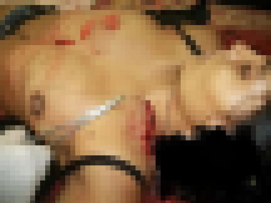 【※超・閲覧注意】レイプされてポアされた女性の遺体ギャラリー怖杉・・・（画像30枚）・2枚目