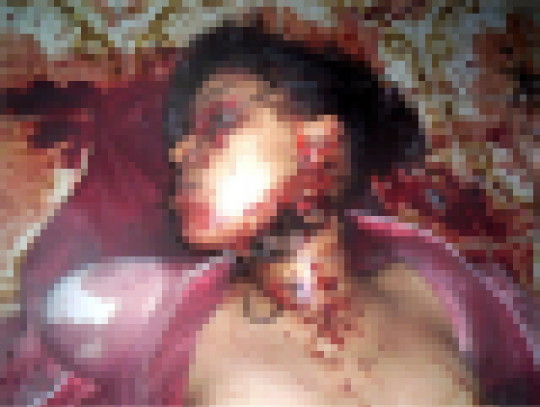 【※超・閲覧注意】レイプされてポアされた女性の遺体ギャラリー怖杉・・・（画像30枚）・4枚目