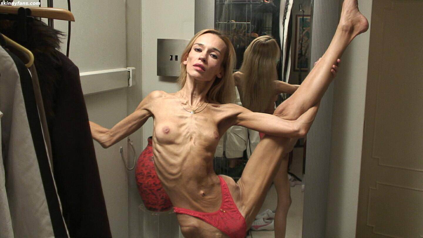 Anorexic sluts